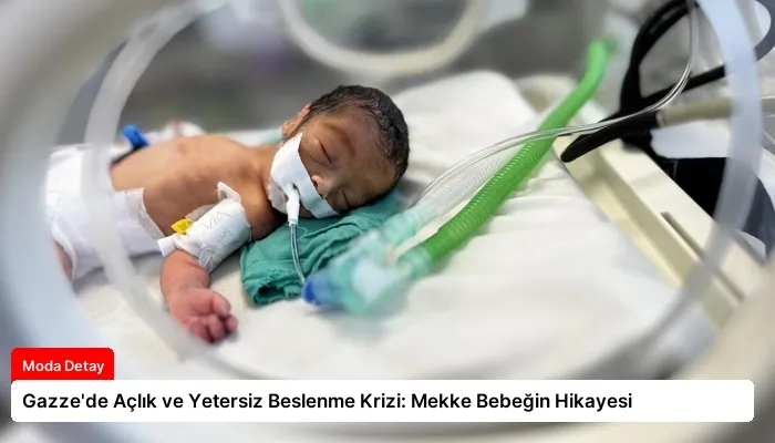Gazze’de Açlık ve Yetersiz Beslenme Krizi: Mekke Bebeğin Hikayesi