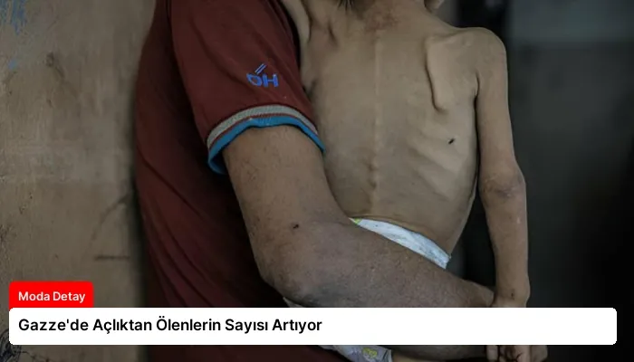 Gazze’de Açlıktan Ölenlerin Sayısı Artıyor
