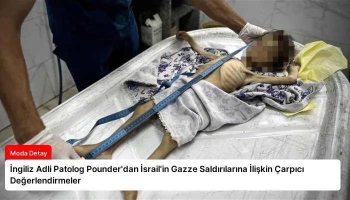 İngiliz Adli Patolog Pounder’dan İsrail’in Gazze Saldırılarına İlişkin Çarpıcı Değerlendirmeler