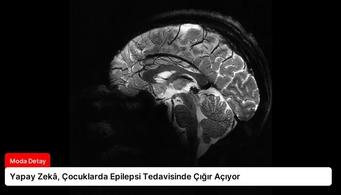 Yapay Zekâ, Çocuklarda Epilepsi Tedavisinde Çığır Açıyor