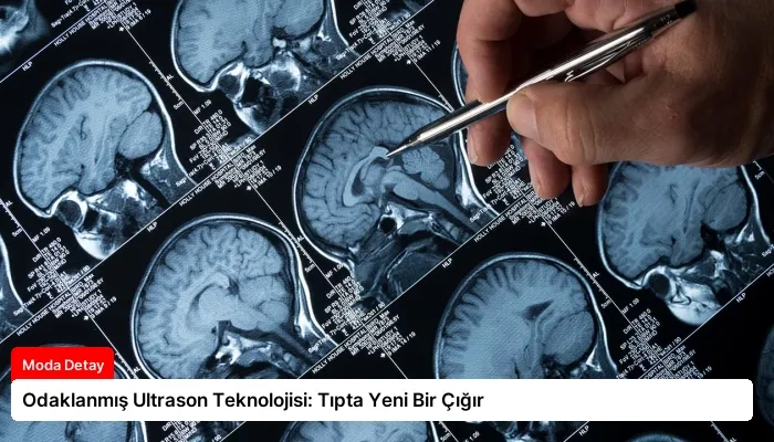 Odaklanmış Ultrason Teknolojisi: Tıpta Yeni Bir Çığır