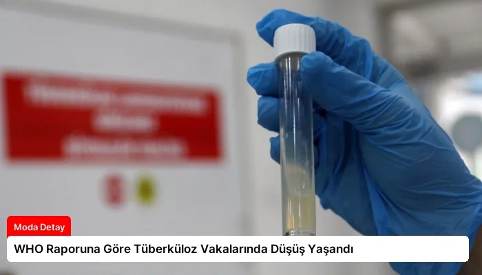 WHO Raporuna Göre Tüberküloz Vakalarında Düşüş Yaşandı