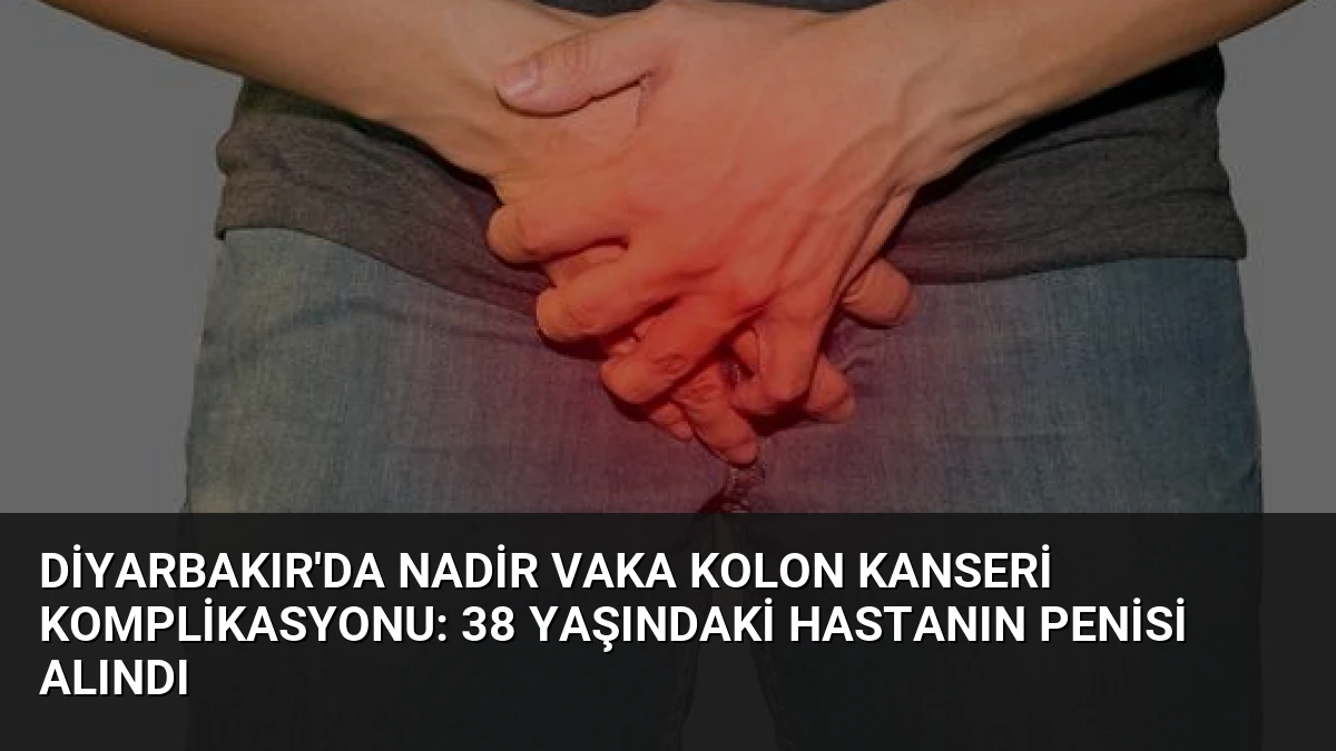 Diyarbakır’da Nadir Vaka Kolon Kanseri Komplikasyonu: 38 Yaşındaki Hastanın Penisi Alındı