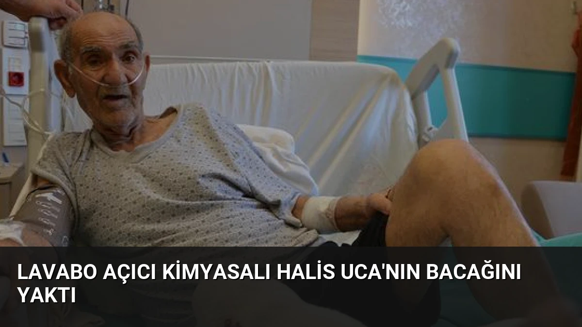 Lavabo Açıcı Kimyasalı Halis Uca’nın Bacağını Yaktı