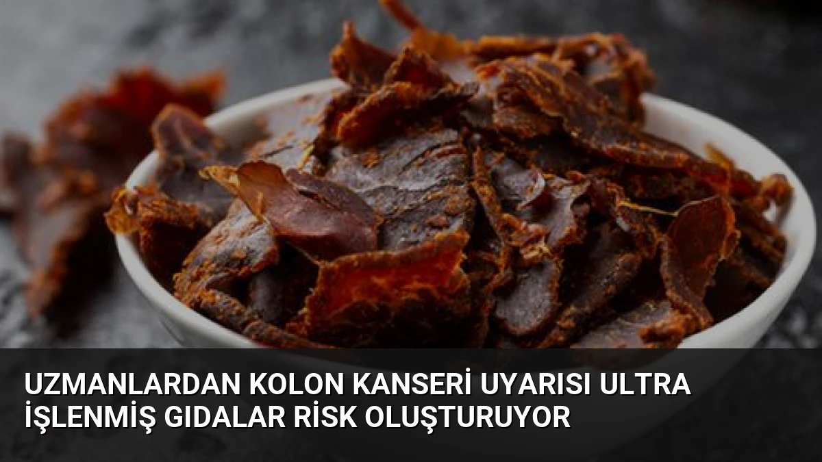 Uzmanlardan Kolon Kanseri Uyarısı Ultra İşlenmiş Gıdalar Risk Oluşturuyor