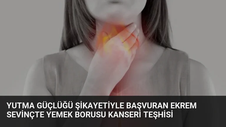 Yutma Güçlüğü Şikayetiyle Başvuran Ekrem Sevinçte Yemek Borusu Kanseri Teşhisi