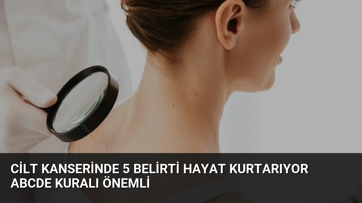 Cilt Kanserinde 5 Belirti Hayat Kurtarıyor ABCDE Kuralı Önemli