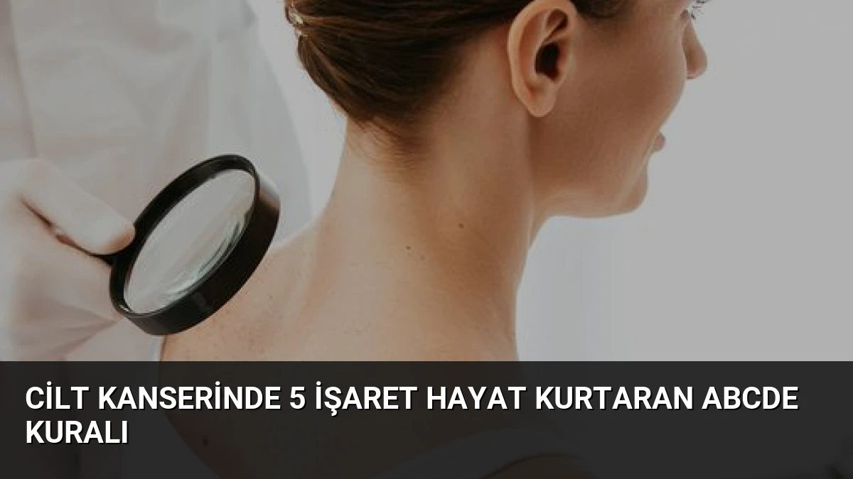 Cilt Kanserinde 5 İşaret Hayat Kurtaran ABCDE Kuralı