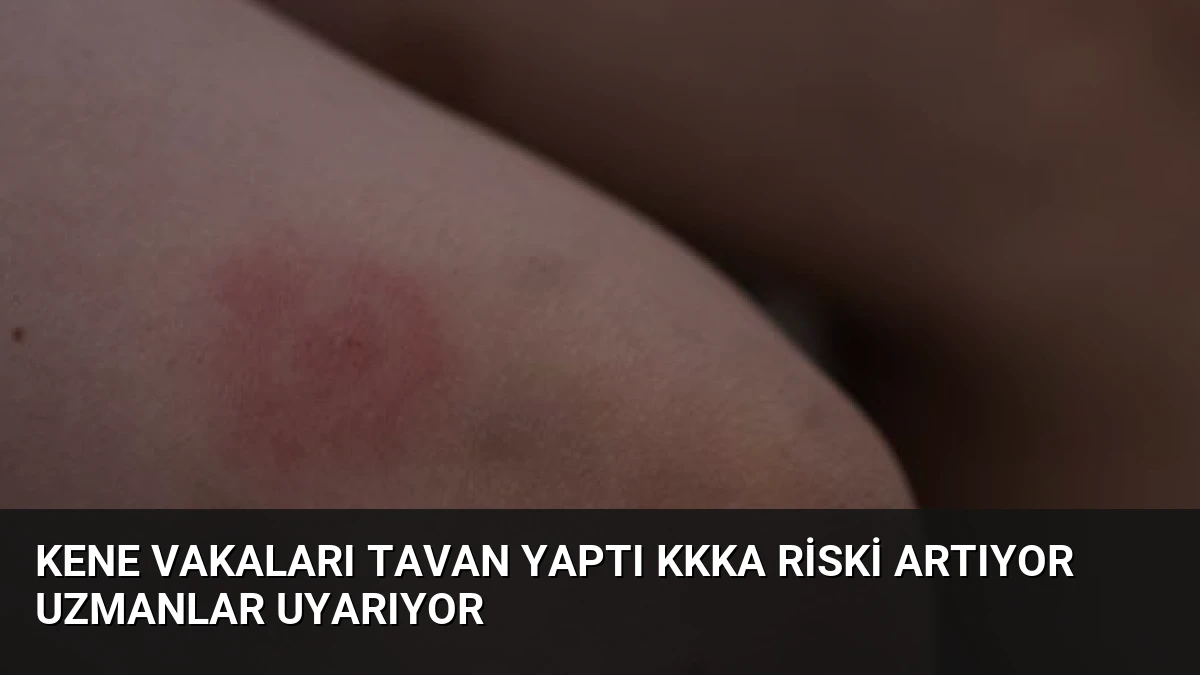 Kene Vakaları Tavan Yaptı KKKA Riski Artıyor Uzmanlar Uyarıyor