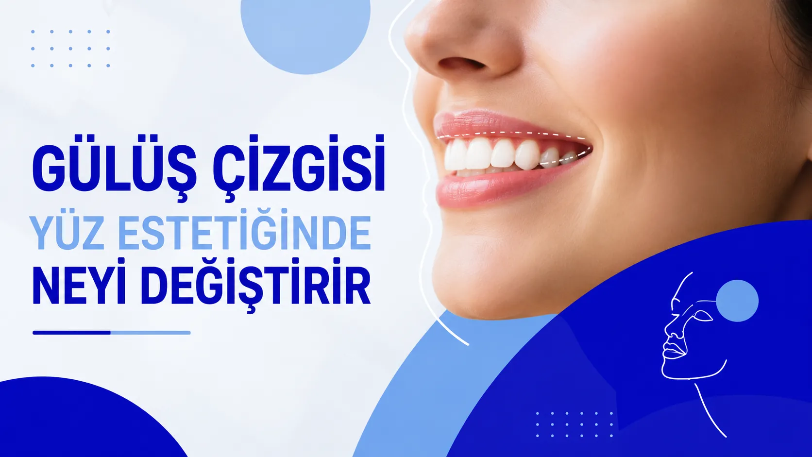 Gülüş Çizgisi Yüz Estetiğinde Neyi Değiştirir